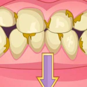 Погане перетворення зубів